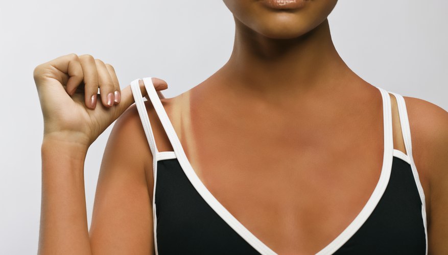 Shoulder straps are often tan line culprits.