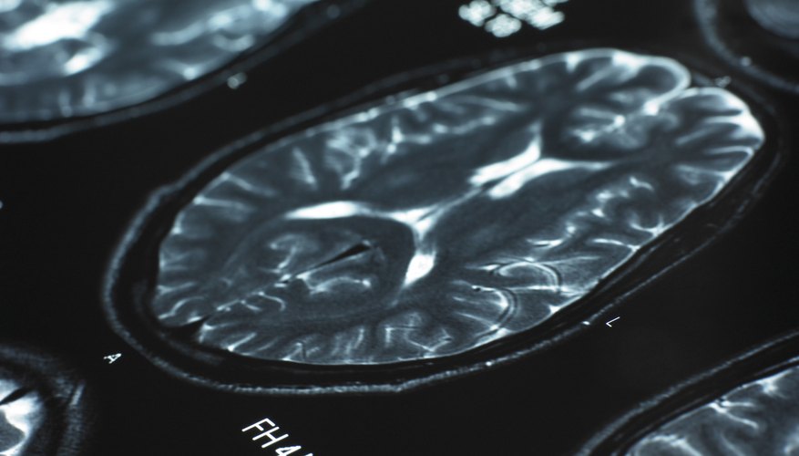 Because psychiatrists are doctors with a medical degree, students must prepare for the MCAT and the medical school curriculum like all other pre-med students.