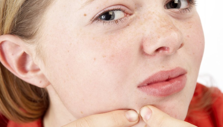 Don't pop your zits! There are better ways to get a pimple-free, healthy face.