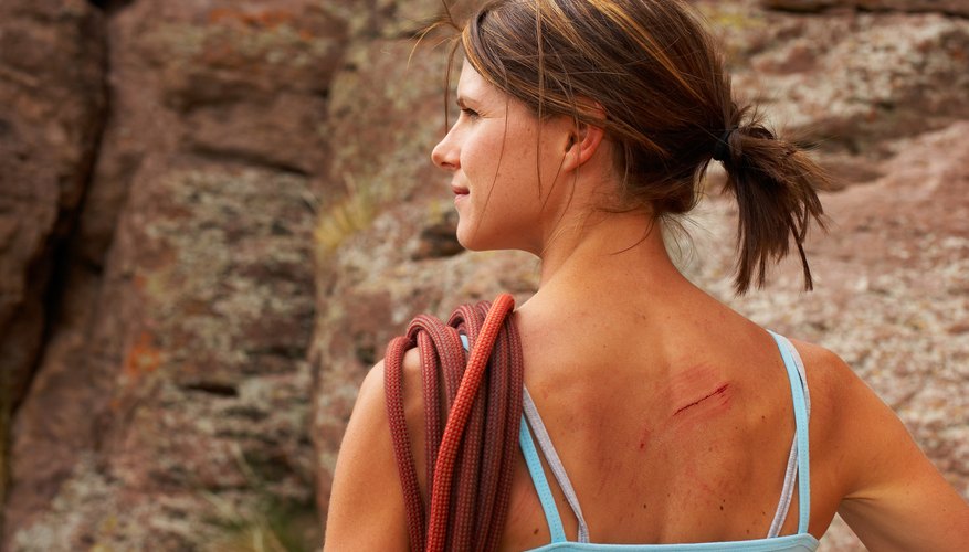 Don't let scars ruin your summer vacation.