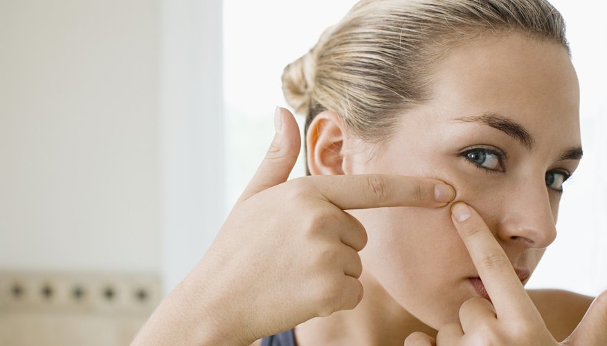 Never use your fingernails to pop a pimple.