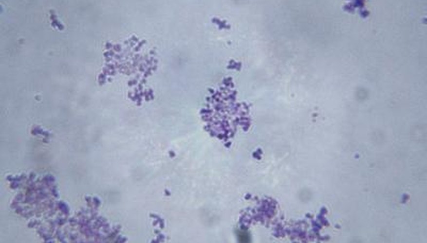 Staphylococcus aureus is a member of the kingdom formerly known as Monera.