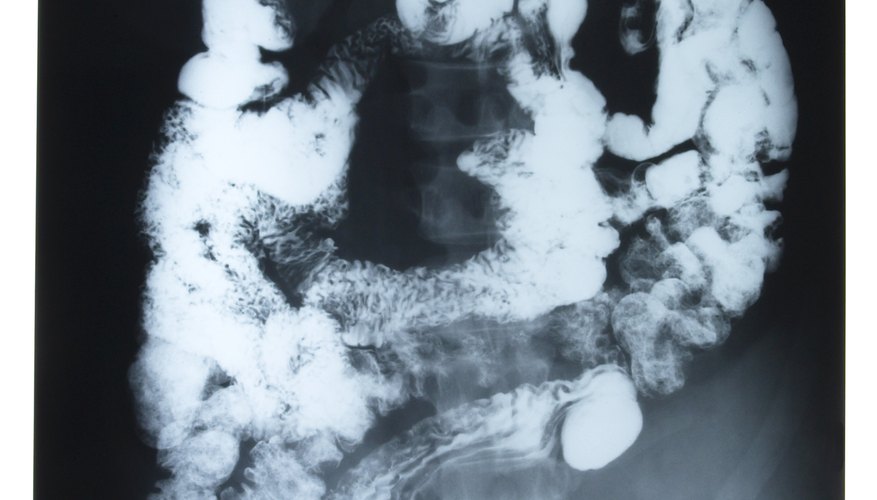 An associate degree in radiology teaches basic medical-imaging techniques.