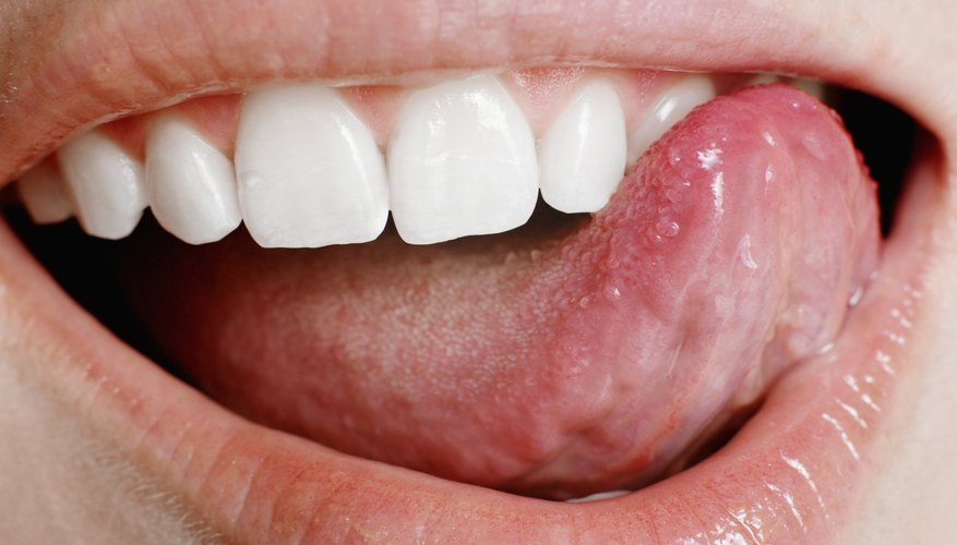 bump-on-tongue-can-be-caused-by-this-disease-vibonaci