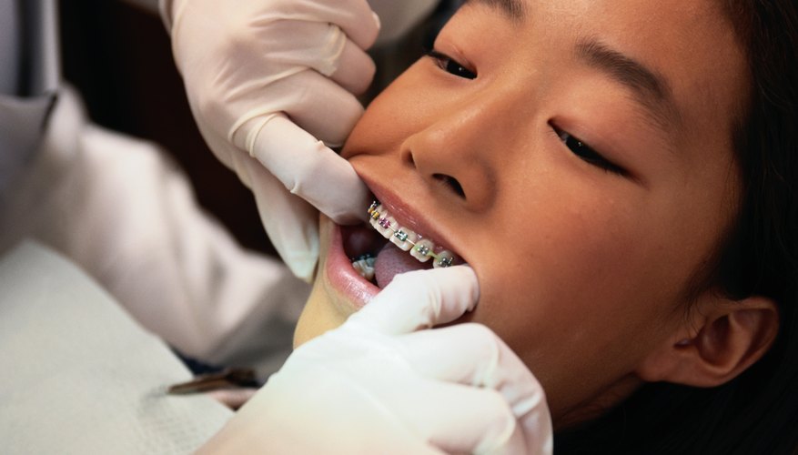 Close-up of woman having her braces checked.