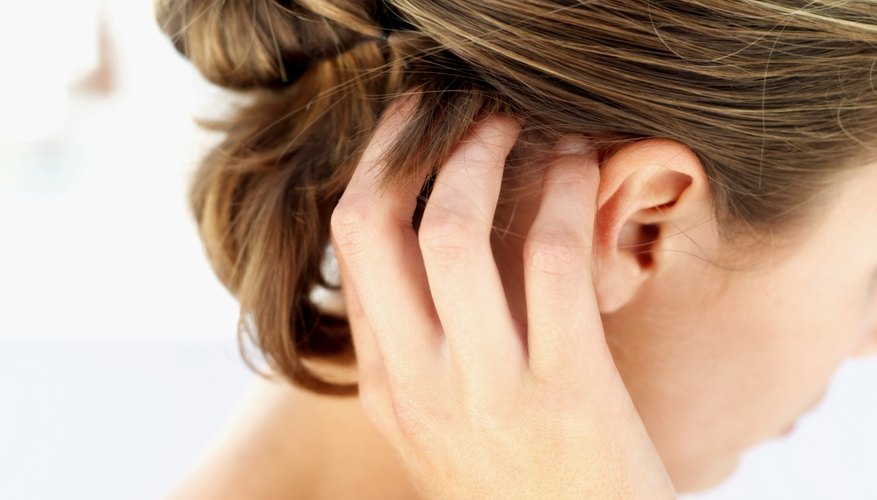 Resist the urge to scratch your scalp, which can make dandruff worse.