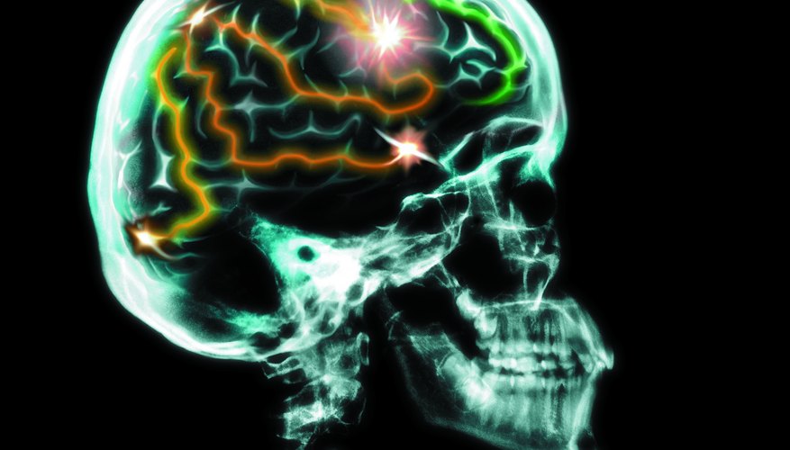 The process of cephalization takes place at the species level and higher..