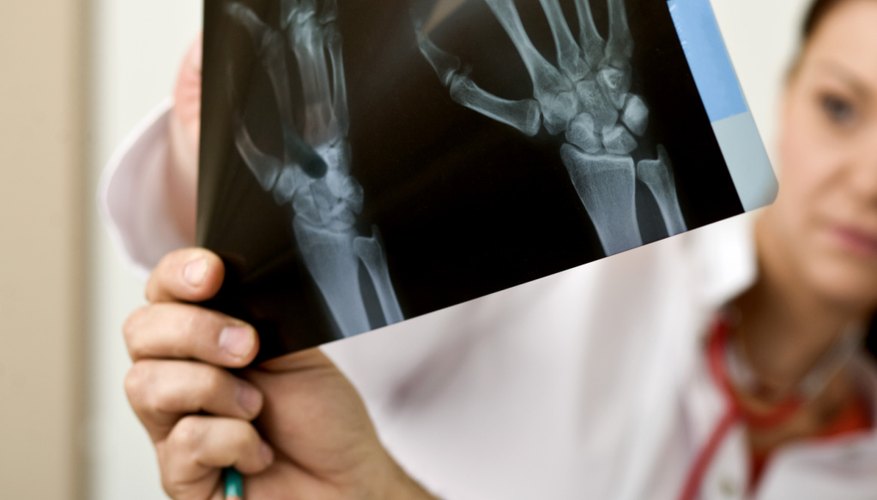 Bones are crucial to the human body.