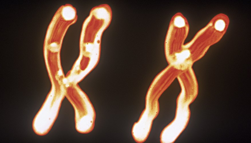 scids tell on what chromosome