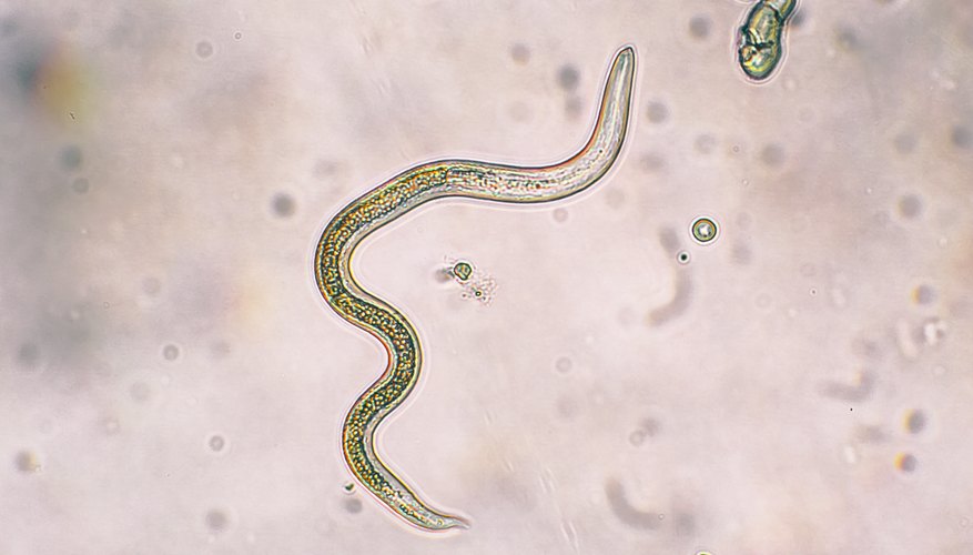 what-does-a-roundworm-look-like-sciencing