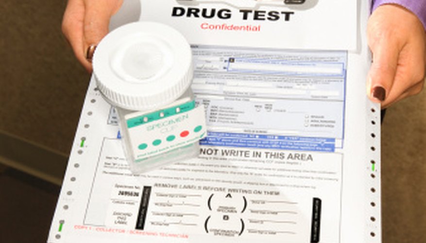 what-are-the-causes-of-a-false-positive-drug-test-healthy-living