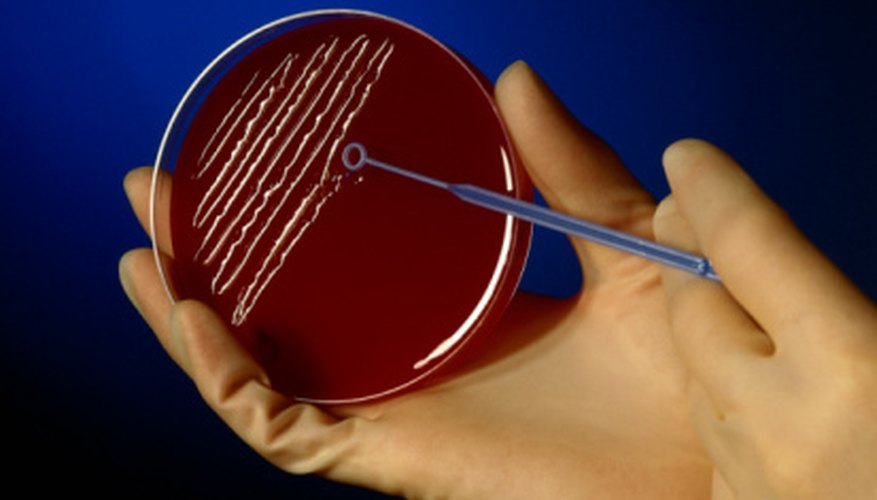 how-to-calculate-the-amount-of-bacteria-present-sciencing