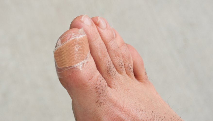 how-to-fix-an-infected-great-toe-healthy-living