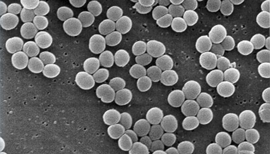Staphylococcus aureus