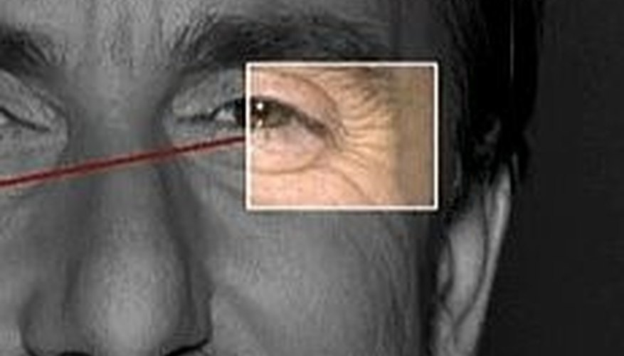 Crows Feet