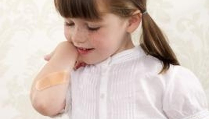 Minor burns only affect the outer layer of skin. Minor burns only affect the outer layer of skin.