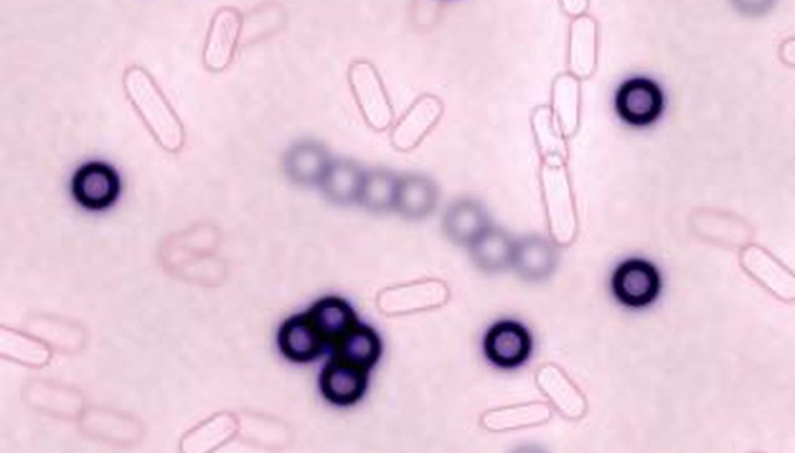 How Do Thiobacillus Bacteria Get Into a Household? | Garden Guides