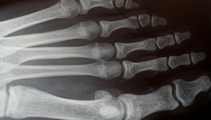 Los radiólogos son médicos que se especializan en radiología.