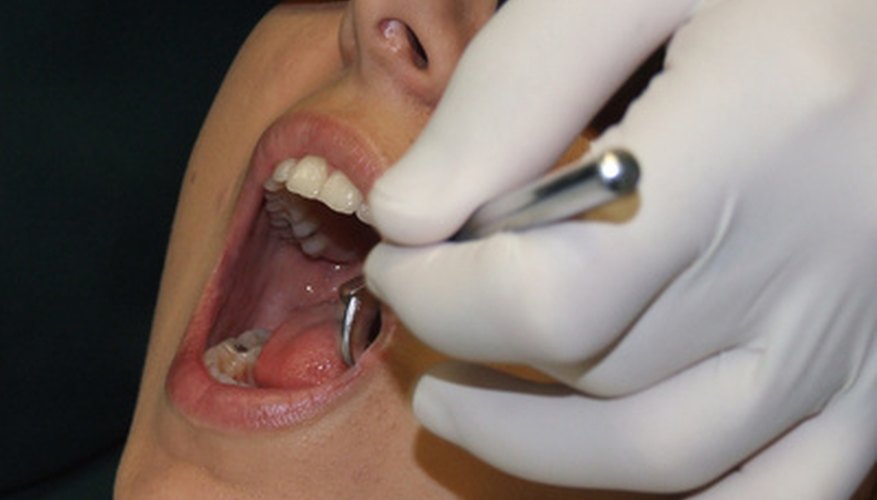 With a dental plan, you pay the discounted rate for each procedure.