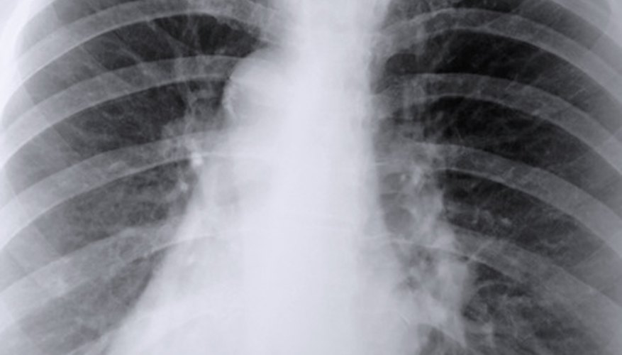 What Are the Functions of Alveoli in the Lungs What Are the Functions of Alveoli in the Lungs