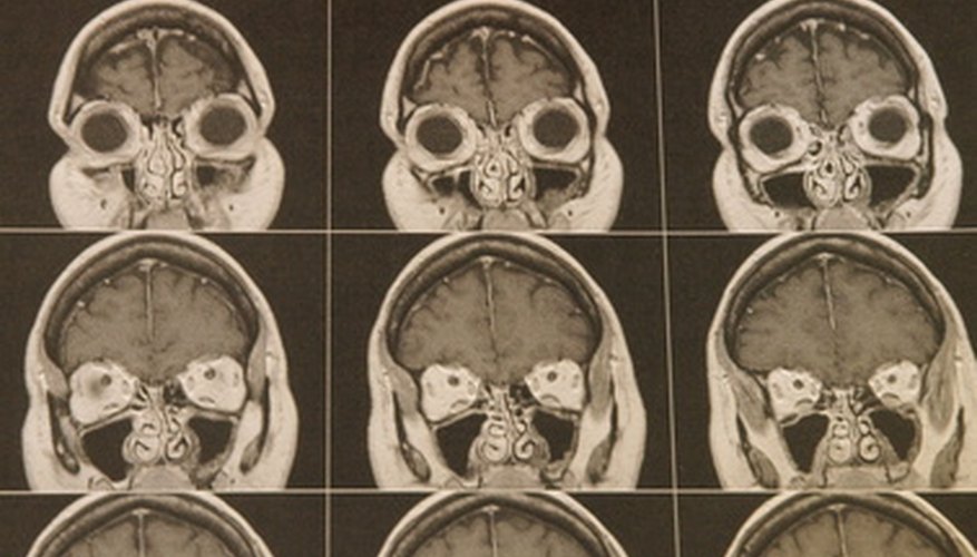 Los nervios salen del cráneo a través de aberturas llamadas foramen.