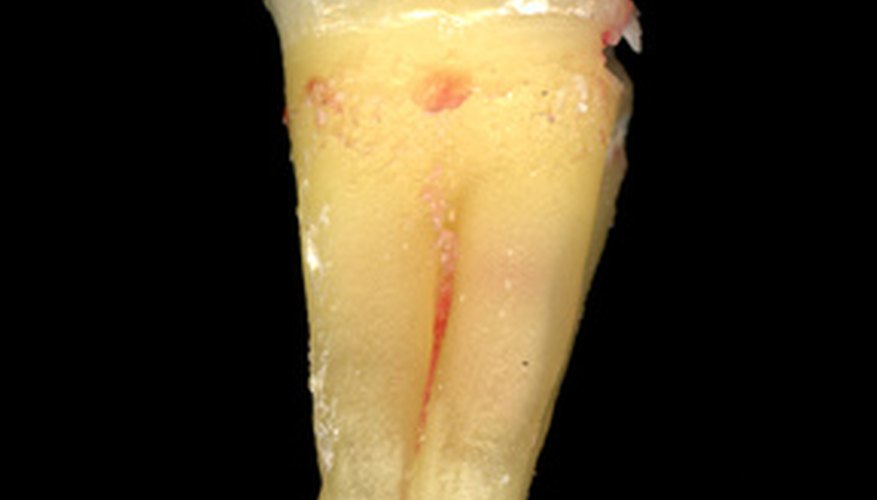 Making models teaches children about tooth anatomy. Making models teaches children about tooth anatomy.