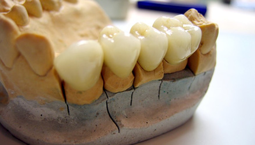 Necesitarás tres moldes diferentes para hacer un conjunto de dientes falsos.