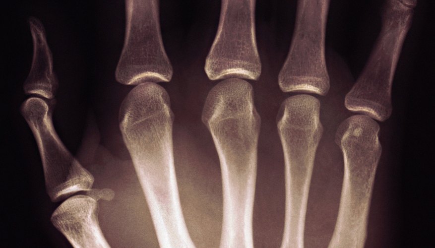 Photo Credit: Image Source/Photodisc/Getty Images Students will be surprised to find that the lengths of finger bones approximate the Fibonacci sequence.