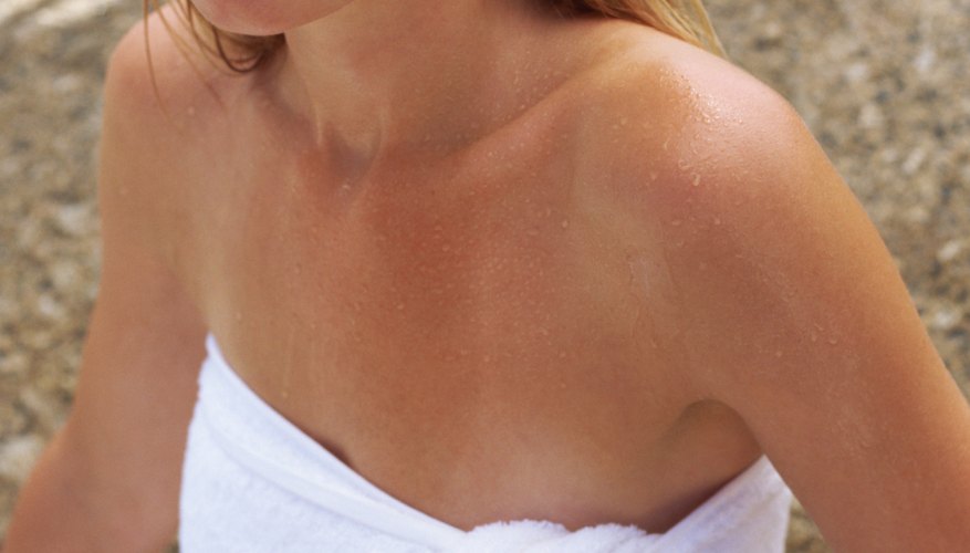 Skin burns when it is exposed to more of the sun's rays than melanin can absorb. Skin burns when it is exposed to more of the sun's rays than melanin can absorb.