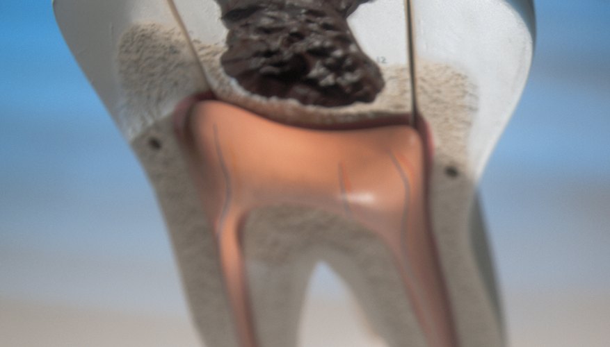 Photo Credit: Stockbyte/Stockbyte/Getty Images Tooth decay is an interesting science fair topic.
