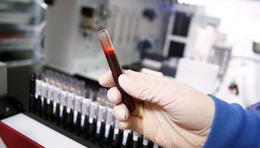 Human Blood Vials Human Blood Vials