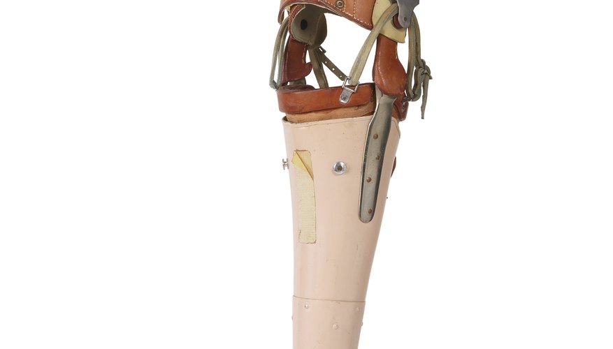 Neuroengineers develop prosthetics for patients with amputated limbs.
