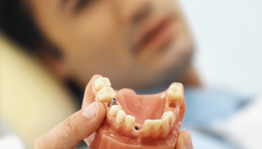 Dentist talking to patient Dentist talking to patient