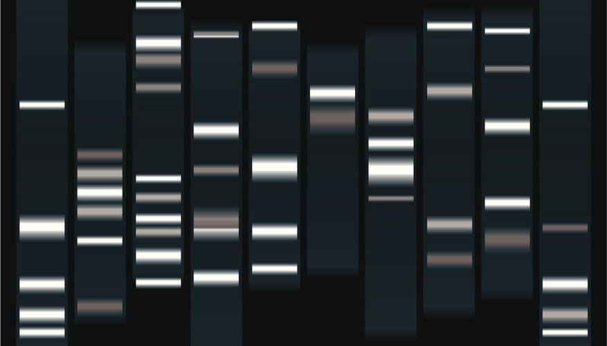 Sources of Error in Gel Electrophoresis Sciencing