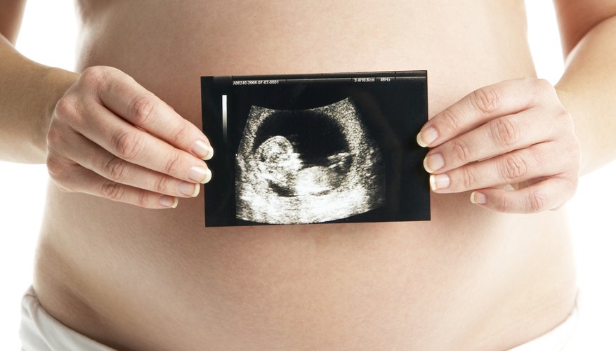 Pregnant woman holding ultrasound image. Pregnant woman holding ultrasound image.
