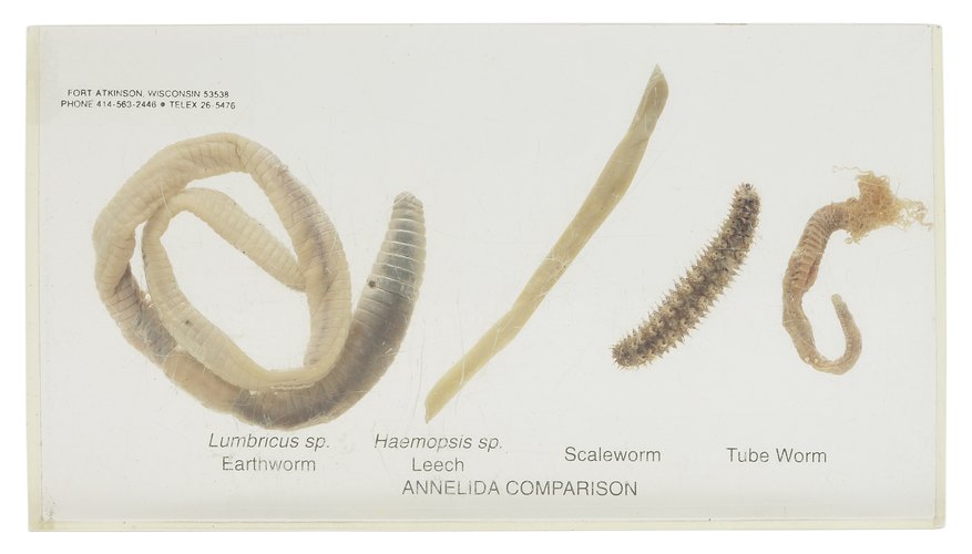 Leeches are a nuisance to swimmers, but fascinating to medical researchers. Leeches are a nuisance to swimmers, but fascinating to medical researchers.