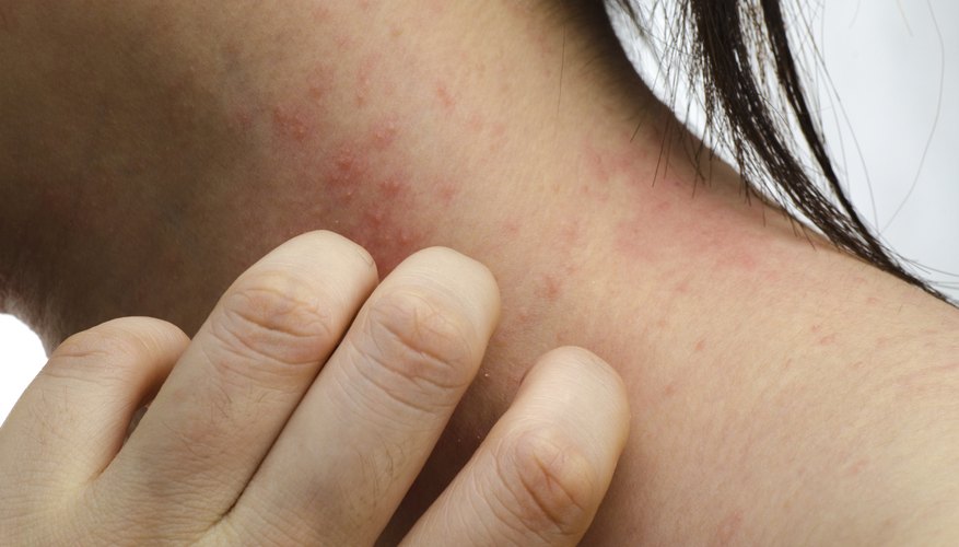 Itching skin. Itching skin.