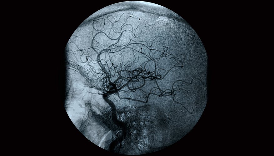 Scan of vascular structure. Scan of vascular structure.