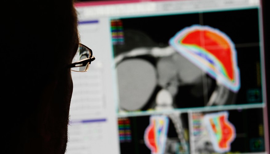 Patients receiving radiation therapy to treat cancer are at risk for lung damage. Patients receiving radiation therapy to treat cancer are at risk for lung damage.
