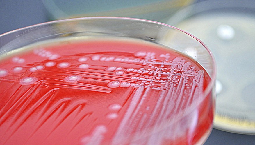 Photo Credit: Scharvik/iStock/Getty Images Close-up of agar plates