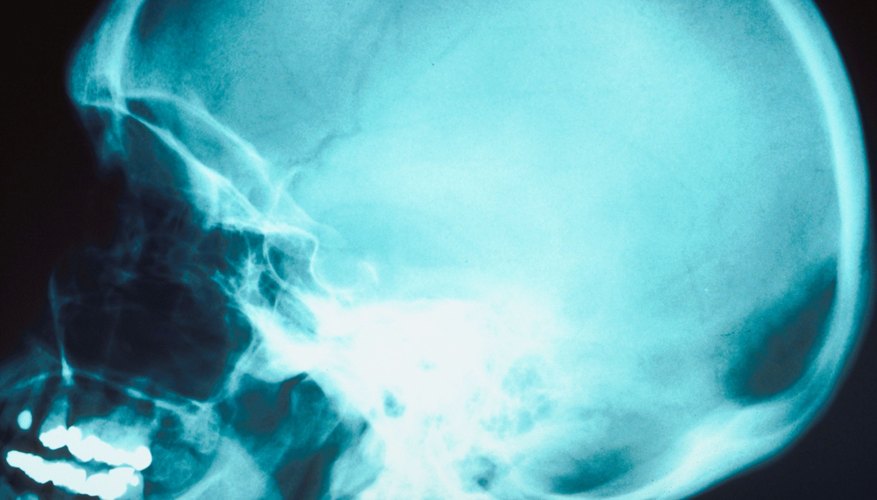 El cerebro humano.