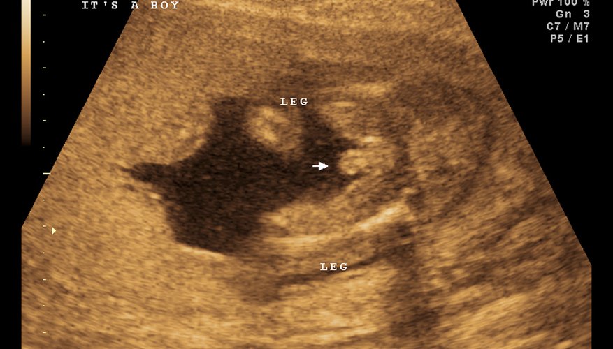 Congenital conditions may occur to a developing fetus. Congenital conditions may occur to a developing fetus.