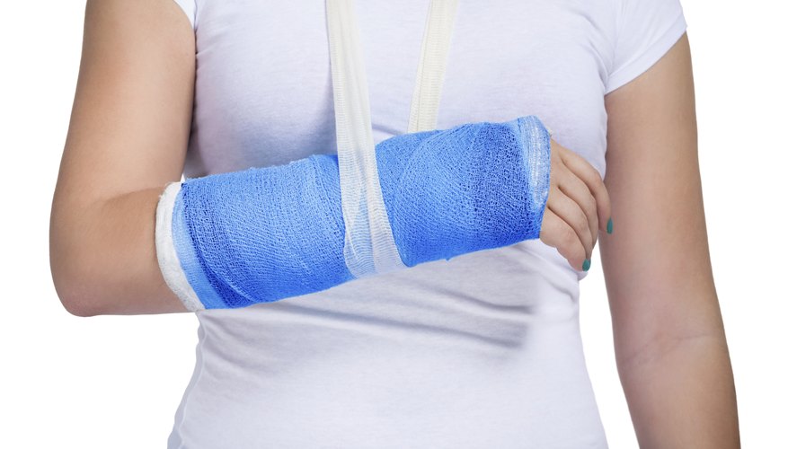 Patient with a cast on arm