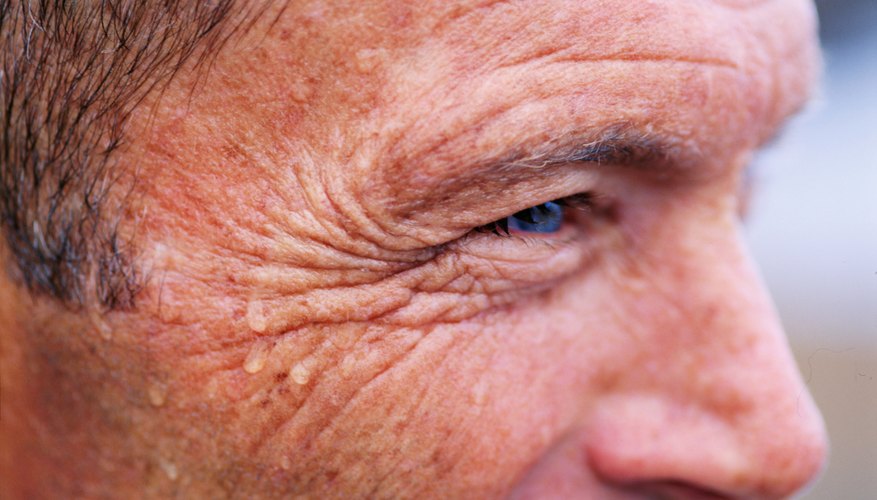 Skin Skin