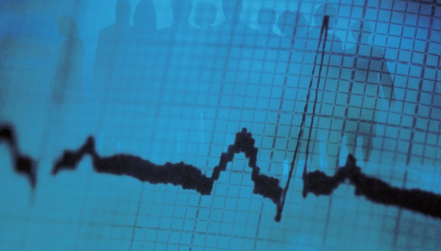 MATLAB permite el filtrado de las señales en frecuencia.