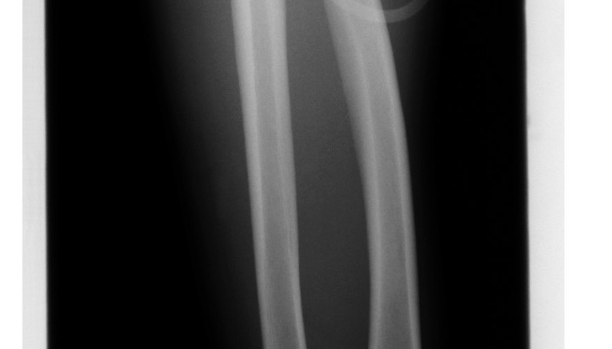 Photo Credit: Thinkstock/Comstock/Getty Images Pivot bones such as the radius and ulna allow for circular movement.