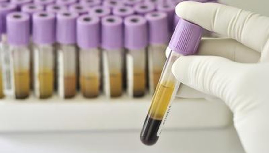 A blood test is one way to get a more accurate, earlier result. A blood test is one way to get a more accurate, earlier result.