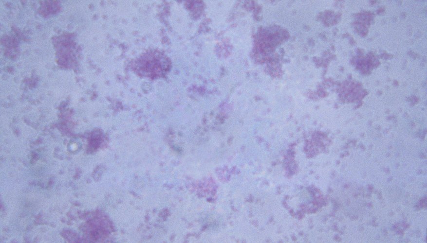 Escherichia coli.