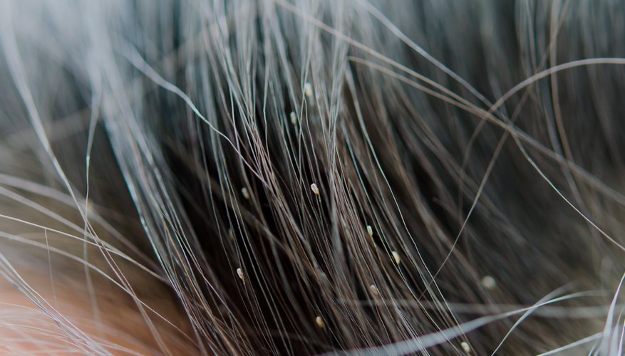 Welche fliegenden Insekten leben in Ihrem Haar, Ihrer Haut und Ihrem Zuhause?