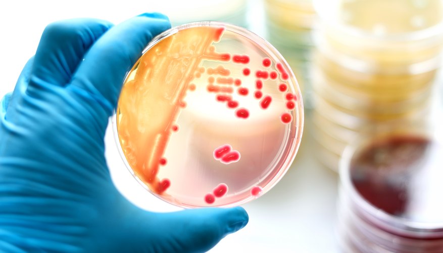 How to Measure Bacterial Growth in Petri Dishes | Sciencing